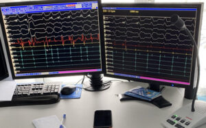 Когда сердце не в порядке: что нужно знать о пороках сердца